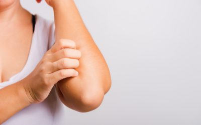 Otoño y pieles atópicas